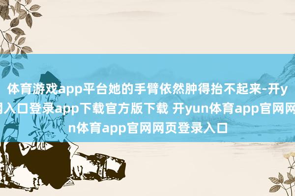 体育游戏app平台她的手臂依然肿得抬不起来-开yun体育官网入口登录app下载官方版下载 开yun体育app官网网页登录入口